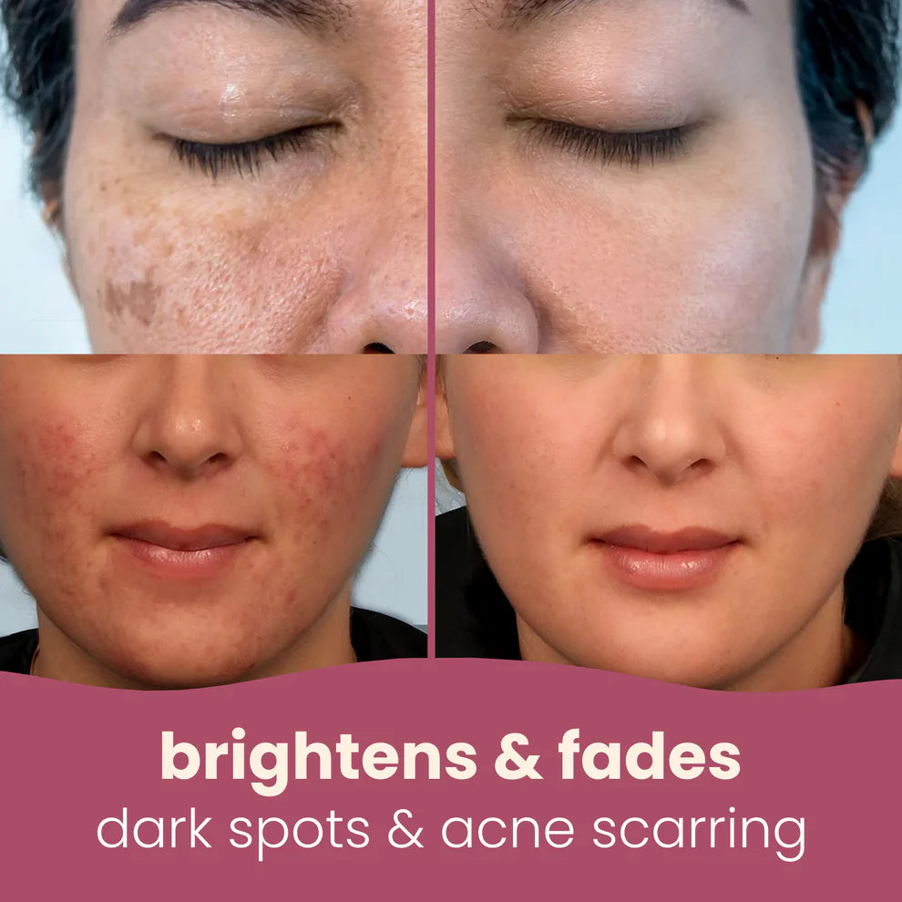 Tumeric Kojic Acid Pads